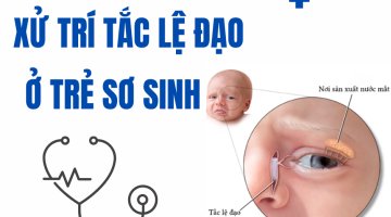 XỬ TRÍ TẮC LỆ ĐẠO Ở TRẺ SƠ SINH